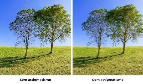 visao astigmatismo