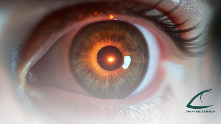 Como saber se tenho glaucoma sintomas iniciais: sinais que você não pode ignorar