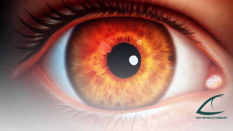 Como identificar descolamento de retina sintomas: sinais que podem salvar sua visão