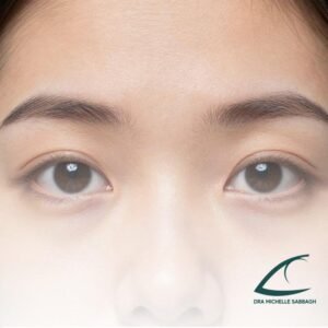 Olhos saltados podem ser problema de tireoide: entenda causas e cuidados urgentes