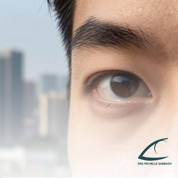 Como é a visao de quem tem astigmatismo? Descubra os sinais e tratamentos